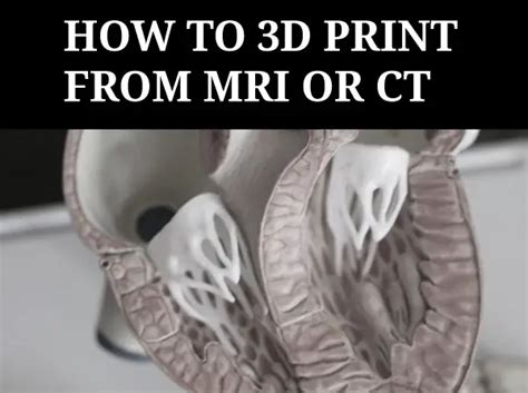 How to 3D Print from CT or MRI Scans .